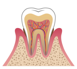 軽度の歯周病